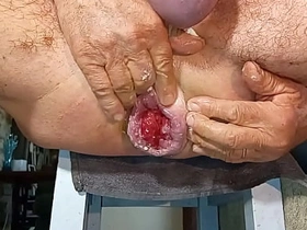 扩肛侠2025-14 asian village gay boys sex videos