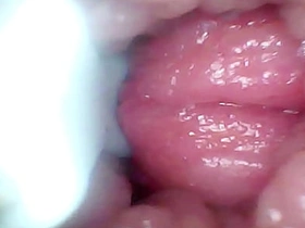 内窥镜拍下我老婆的G点。教学视频 hairy chinese gay porn