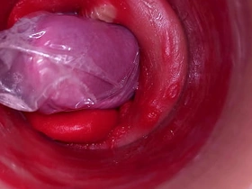 深入阴道的摄像头记录下带着套套的巨量射精 japanese trans gay porn